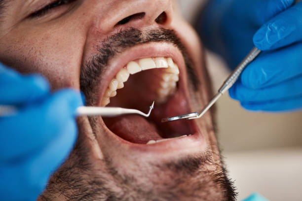 Best Emergency Dental Services for Seniors in Milan, TN